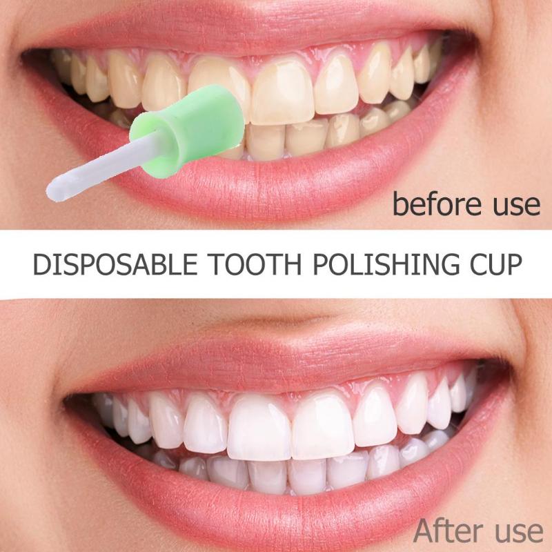 Dental Prophylaxis or Teeth Cleaning in Lucknow