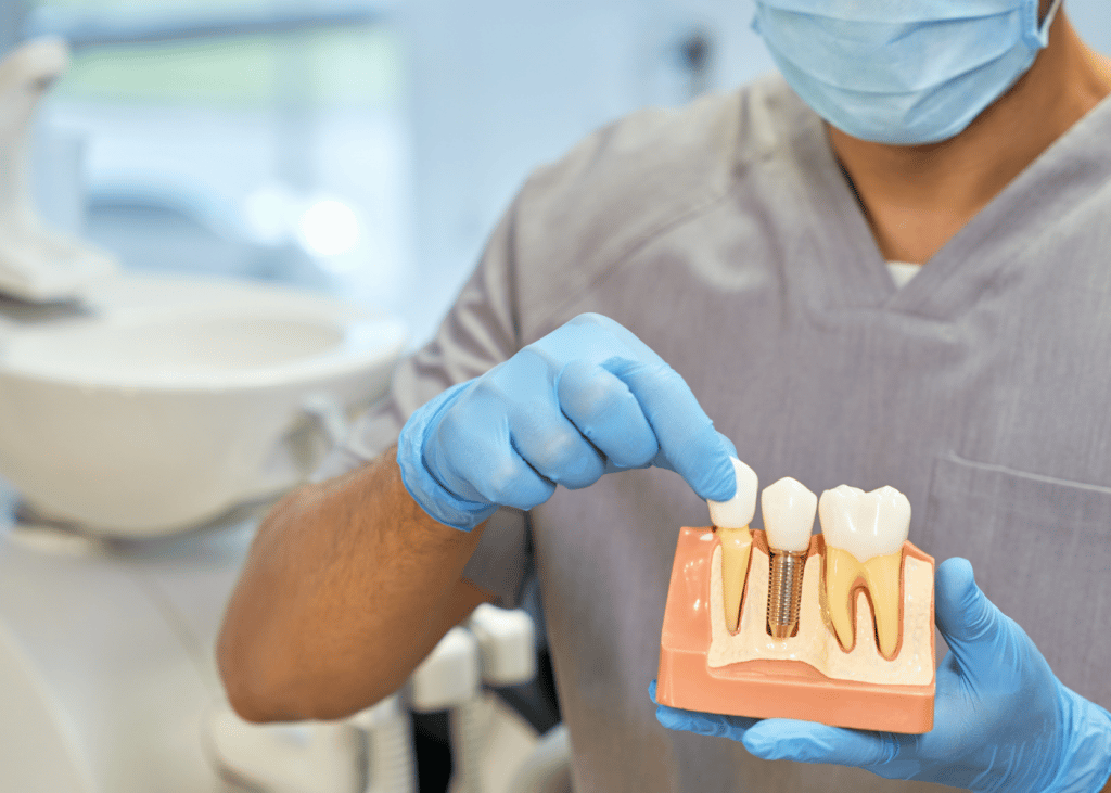 HOW LONG DO DENTAL IMPLANTS LAST?