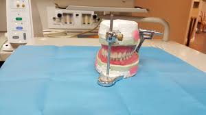 WHAT IS THE AVERAGE COST OF DENTAL IMPLANTS